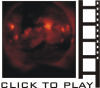 X-Ray Filter Movie